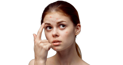 Acne & Acne Scar Treatment